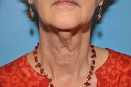 Neck Photos