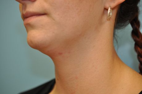 Neck Photos