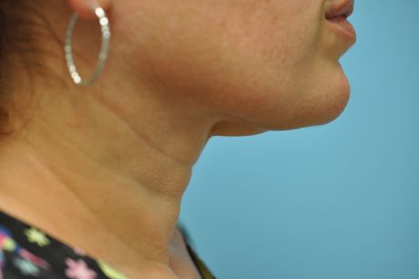 Neck Photos