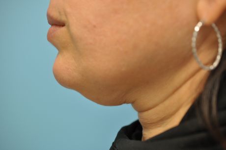 Neck Photos