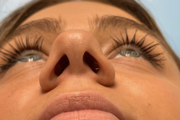 Nose Photos