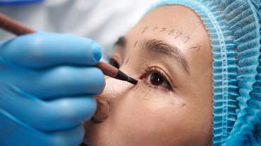 Browlift or Blepharoplasty