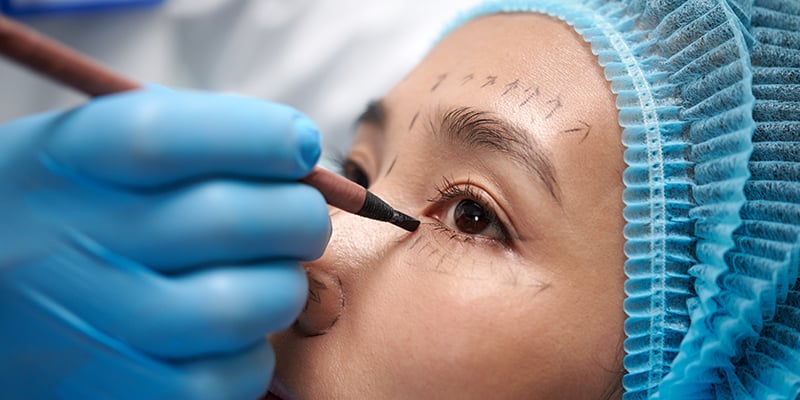 Browlift or Blepharoplasty