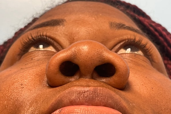 Nose Photos