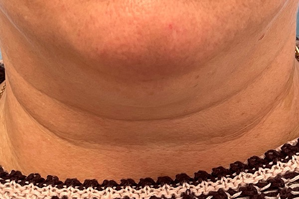 Neck Photos