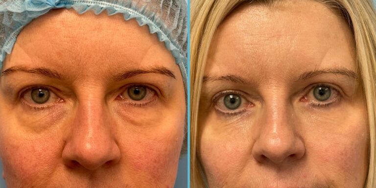 Dr. Janjua: Top Facial Plastic Surgeon in New Jersey