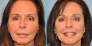 Janjua Facial Surgery Homepage