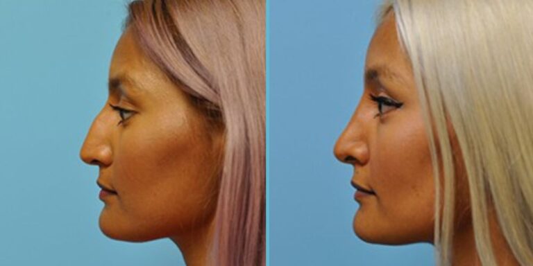 Dr. Janjua: Top Facial Plastic Surgeon in New Jersey