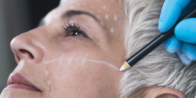 Anti-Aging Concept. Doctor's hand in blue surgical glove marking senior women's face for cosmetic injections.